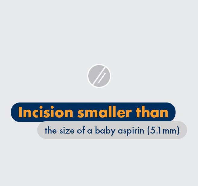 Graphic - Incision smaller than the size of a baby aspirin (5.1 mm)