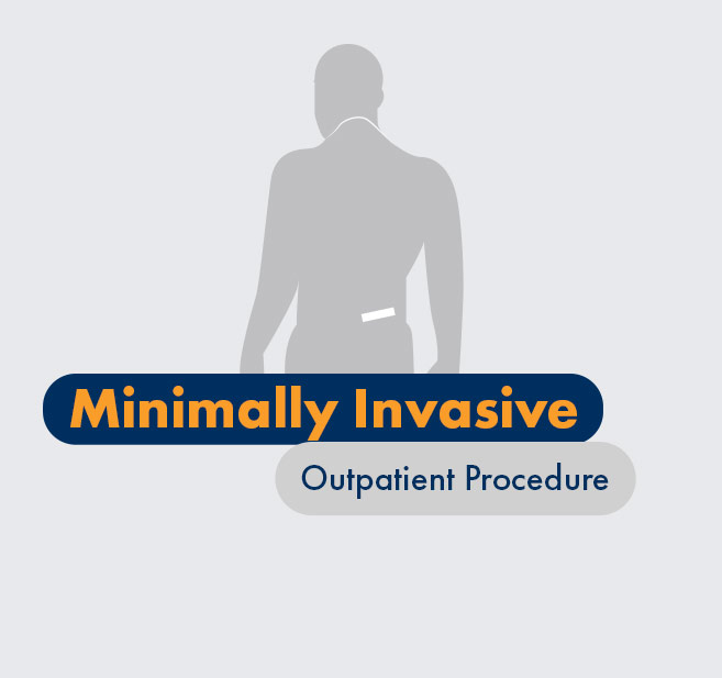 Graphic - Patient - Minimally invasive outpatient procedure