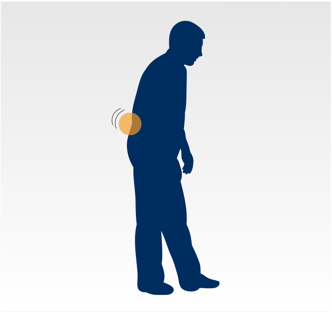 Graphic - Lower back pain while standing