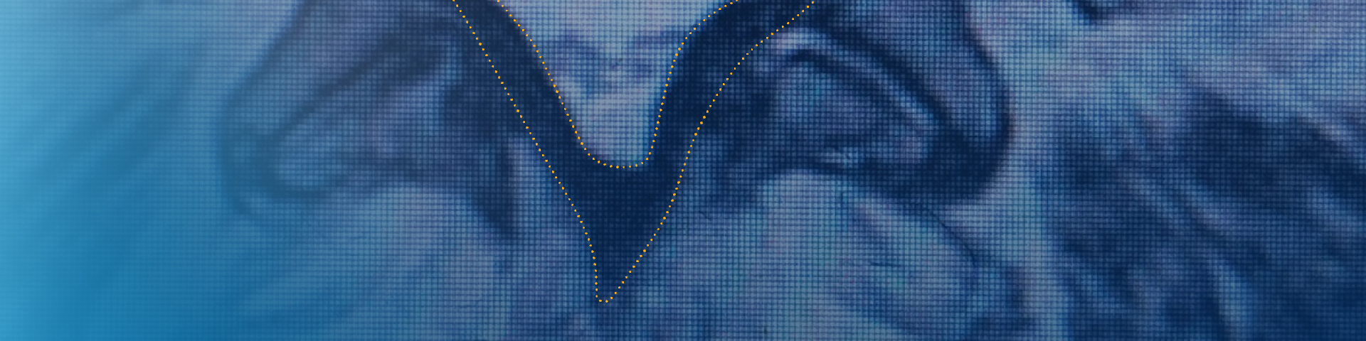 Image showing thickened ligament, resulting in compression of the spinal cord nerves.