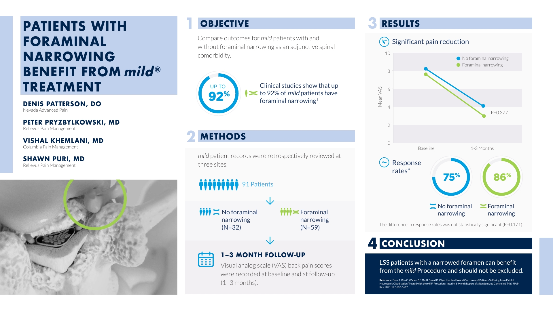 Infographic: Patients with Foraminal Narrowing Benefit from mild Treatment