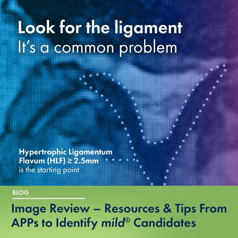 "Look for the ligament. It's a common problem. Hypertrophic Ligamentum Flavum (HLF) >= 2.5mm is the starting point."