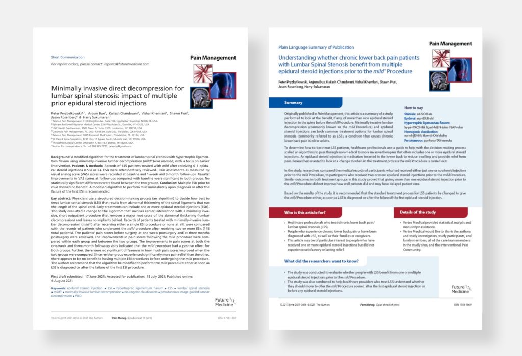 Image of article about minimally invasive direct decompression for lumbar spinal stenosis