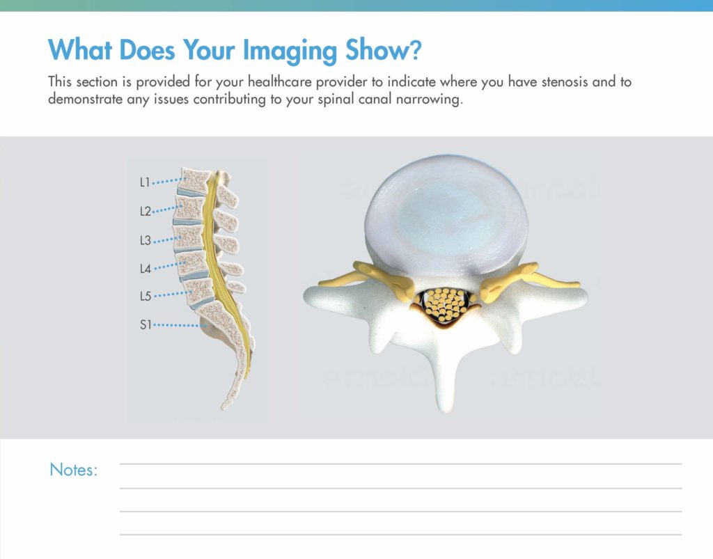 What does your imaging show?
